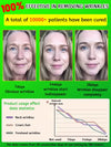 Retinol Serum for Reducing Fine Lines, Moisturizing, Wrinkle Removal, Facial Skin Care, Korean Skin Care 30G, Facial Care
