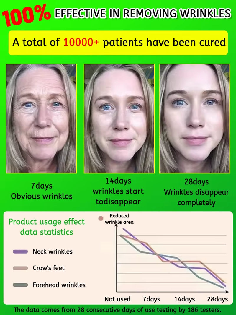 Retinol Serum for Reducing Fine Lines, Moisturizing, Wrinkle Removal, Facial Skin Care, Korean Skin Care 30G, Facial Care