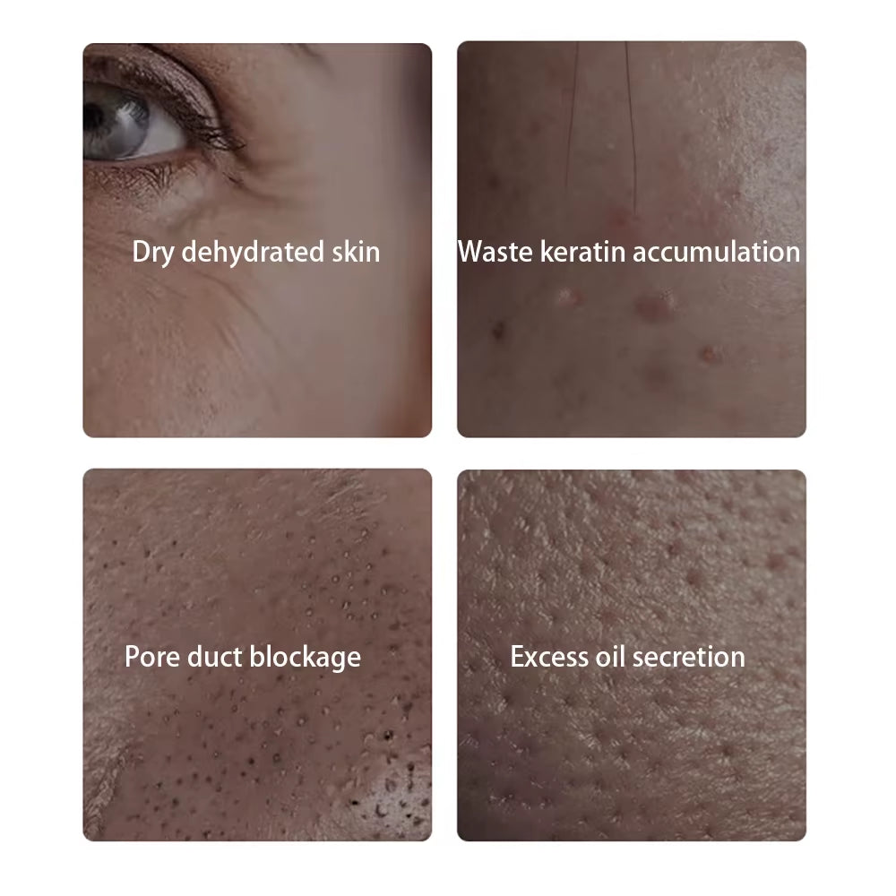 Camellia Seed Leukocyte Essence Facial Care Brighten Skin Moisturizing Soothing Oil Control Face Serum Korea Skin Care Products